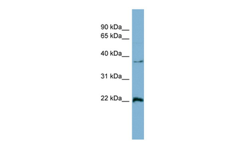 RAN Rabbit Polyclonal Antibody