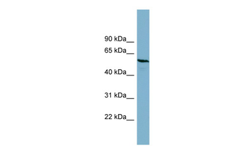 PGM3 Rabbit Polyclonal Antibody
