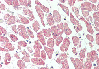 VPS29 Rabbit Polyclonal Antibody