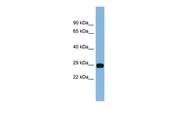 CHCHD3 Rabbit Polyclonal Antibody