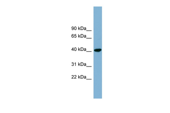 PINX1 Rabbit Polyclonal Antibody
