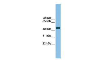 NODAL Rabbit Polyclonal Antibody