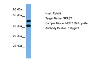 SPAST Rabbit Polyclonal Antibody
