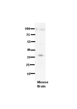 TMPRSS3 Rabbit Polyclonal Antibody