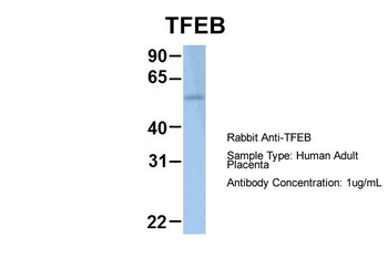 TFEB Rabbit Polyclonal Antibody