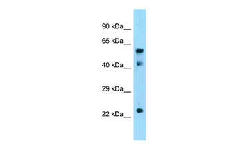 Igf2bp1 Rabbit Polyclonal Antibody