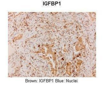 IGF2BP1 Rabbit Polyclonal Antibody
