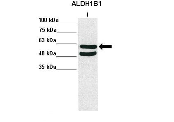 ALDH1B1 Rabbit Polyclonal Antibody