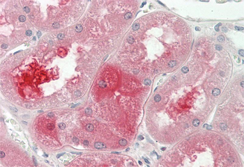 SERPINF2 Rabbit Polyclonal Antibody