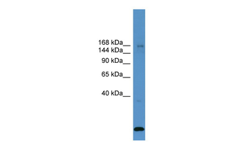 USP47 Rabbit Polyclonal Antibody