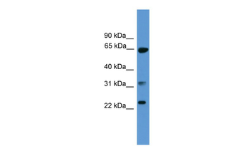 CLTA Rabbit Polyclonal Antibody