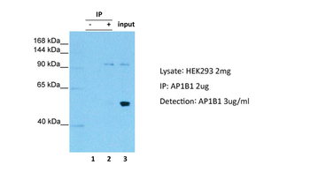 AP1B1 Rabbit Polyclonal Antibody