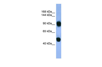 AP1B1 Rabbit Polyclonal Antibody