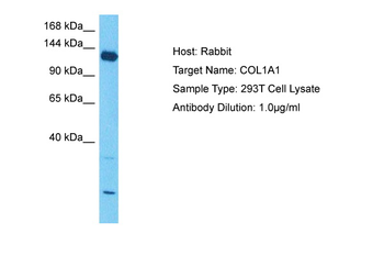 COL1A1 Rabbit Polyclonal Antibody