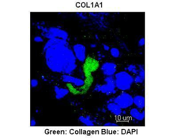 COL1A1 Rabbit Polyclonal Antibody