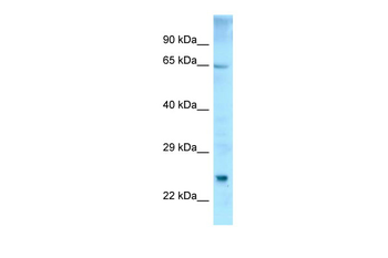 ETFDH Rabbit Polyclonal Antibody