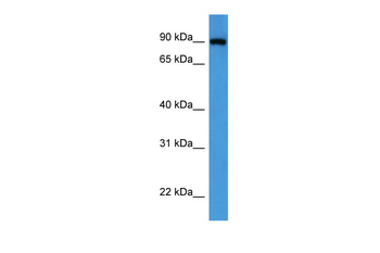 OSBP Rabbit Polyclonal Antibody