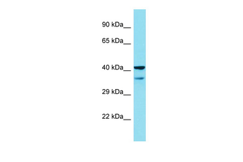 MAPKAPK2 Rabbit Polyclonal Antibody