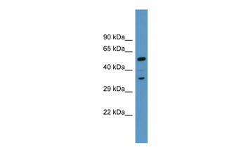 MARCKS Rabbit Polyclonal Antibody