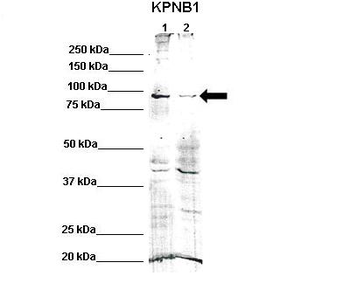 KPNB1 Rabbit Polyclonal Antibody