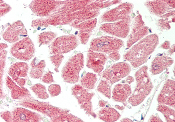 VTI1B Rabbit Polyclonal Antibody