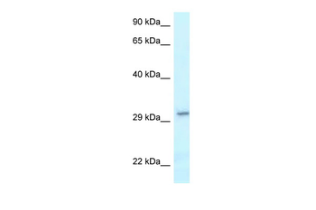 VTI1B Rabbit Polyclonal Antibody