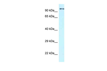 CDK11A Rabbit Polyclonal Antibody