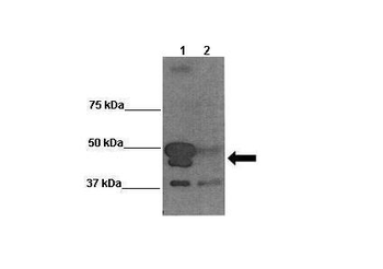BAG5 Rabbit Polyclonal Antibody