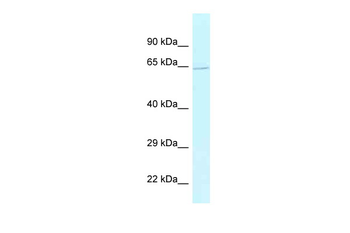 BAG5 Rabbit Polyclonal Antibody