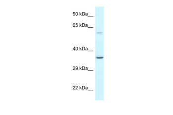 BAG5 Rabbit Polyclonal Antibody