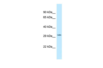 TIPRL Rabbit Polyclonal Antibody