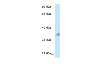 BTLA Rabbit Polyclonal Antibody