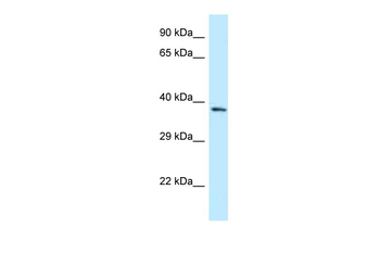 FPGT Rabbit Polyclonal Antibody