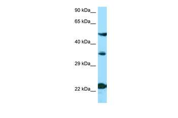 MC4R Rabbit Polyclonal Antibody