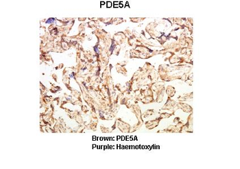 PDE5A Rabbit Polyclonal Antibody