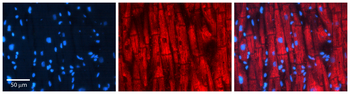 CLPP Rabbit Polyclonal Antibody