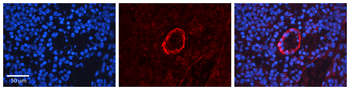NRAS Rabbit Polyclonal Antibody