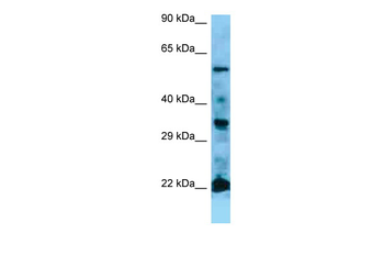 NRAS Rabbit Polyclonal Antibody