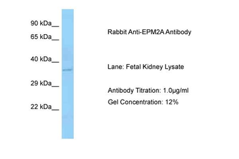 EPM2A Rabbit Polyclonal Antibody
