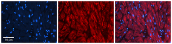 CCT2 Rabbit Polyclonal Antibody