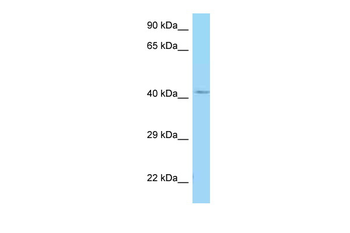GALR1 Rabbit Polyclonal Antibody