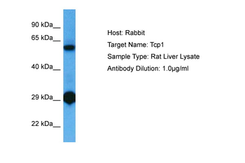 TCP1 Rabbit Polyclonal Antibody
