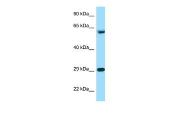 TCP1 Rabbit Polyclonal Antibody
