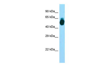 GIPR Rabbit Polyclonal Antibody