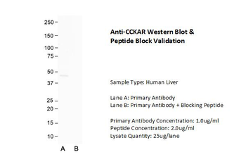 CCKAR Rabbit Polyclonal Antibody