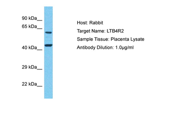 LTB4R2 Rabbit Polyclonal Antibody