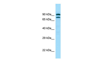 PDE4C Rabbit Polyclonal Antibody