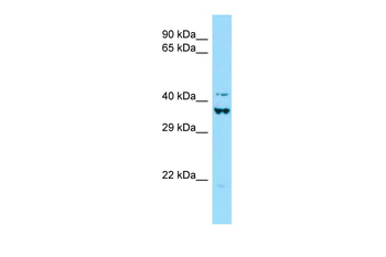 BRCC3 Rabbit Polyclonal Antibody