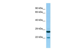 PTGES2 Rabbit Polyclonal Antibody