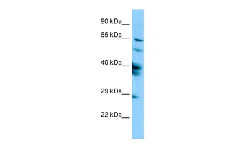 SPAG16 Rabbit Polyclonal Antibody
